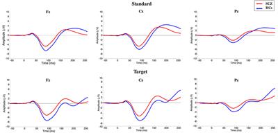 Tracing Links Between Early Auditory Information Processing and Negative Symptoms in Schizophrenia: An ERP Study